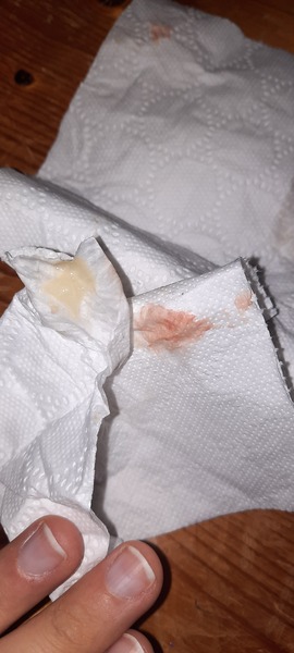 *WARNING TMI PICS* think it's my mucus plug!