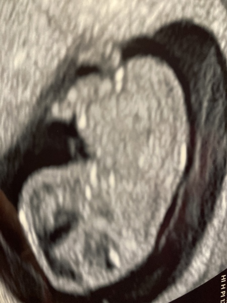 Due late Oct 🎃 - early Nov 🎉