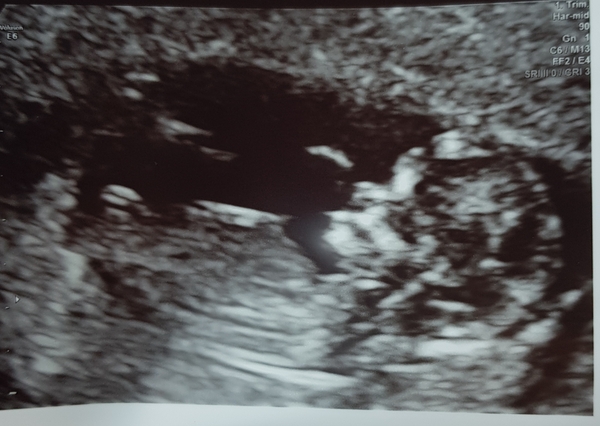Boy or girl 💜💙