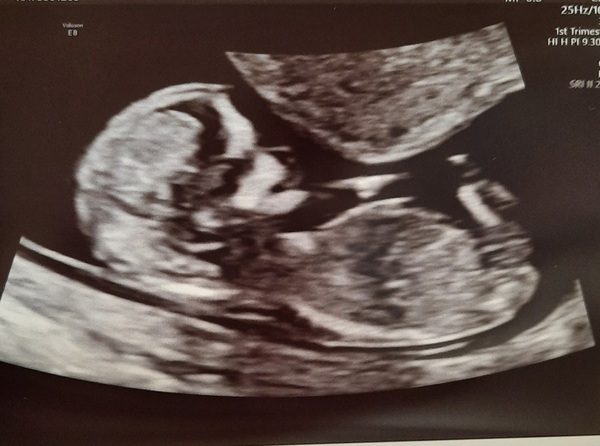 Due September 2022 (Thread 4)