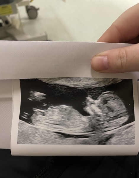 Due October 2022 thread #2 ... the first trimester continues!