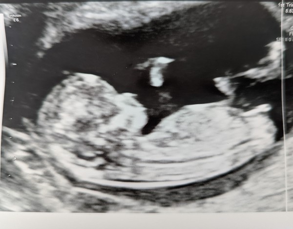 Gender predictions! Nub theory