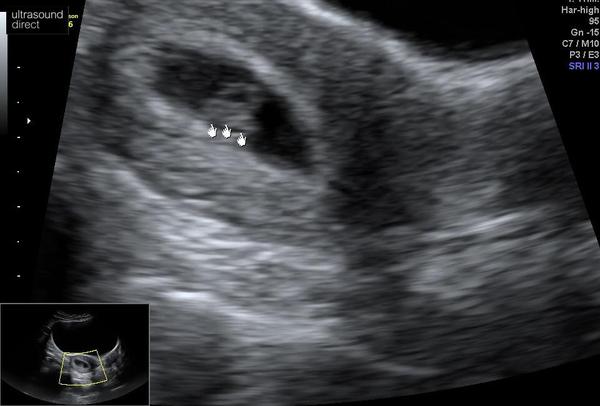 Due November 2022!