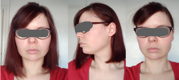 Talk me out (or in!) a pixie!