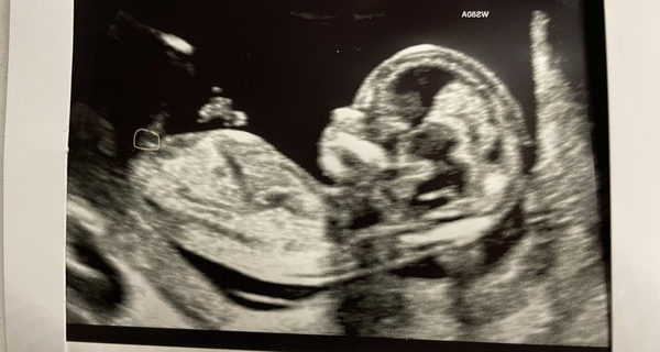 Due September 2022 (Thread 5!)