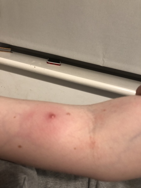A&E or not?