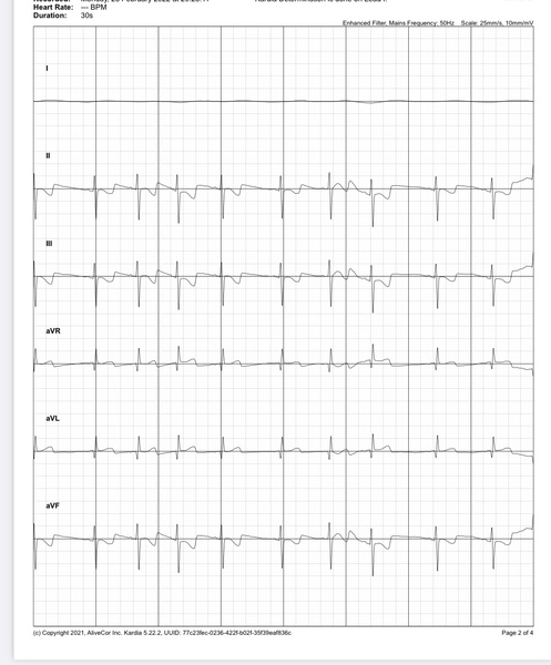 Can anyone read an ECG?