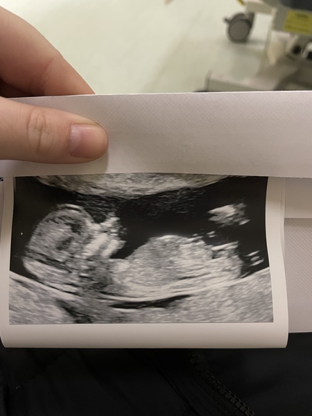 What do we all think girl or boy?