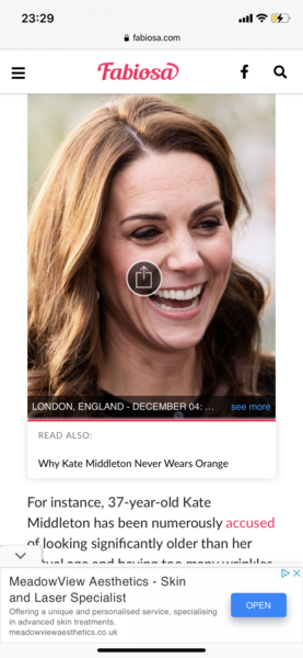 Kate Middleton's amazing face!