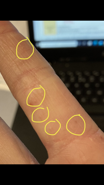 What are these tiny spots!?