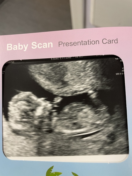 Due September 2022 (Thread 4)