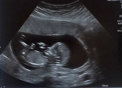 Show me you 12w scan. Am bored and want to test my nub theory 😁