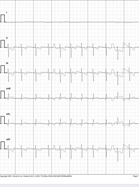 Can anyone read an ECG?