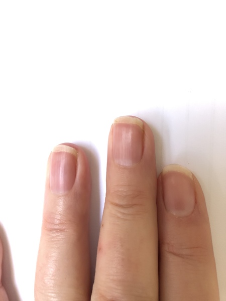 Cuticles?