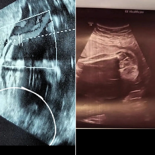 Boy or girlie?