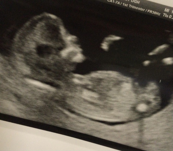 Baby girl or baby boy?