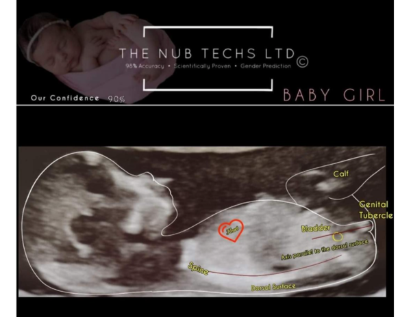 Due September 2022 (Thread 4)