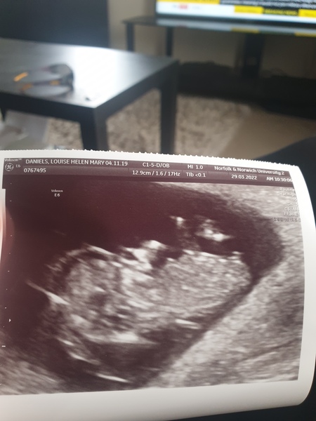 Due October 2022 thread #2 ... the first trimester continues!