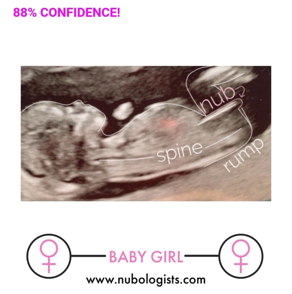 Nubologists correct for you?