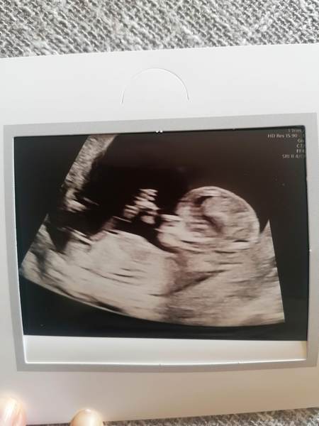 'Nub Theory' Guesses for 12+5 scan?
