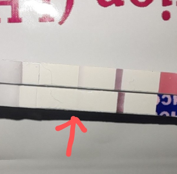 Why would a squinter appear almost straight away