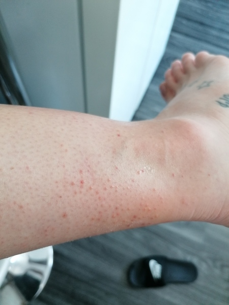 Help with skin condition