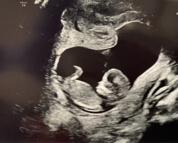 Due September 2022 (Thread 4)