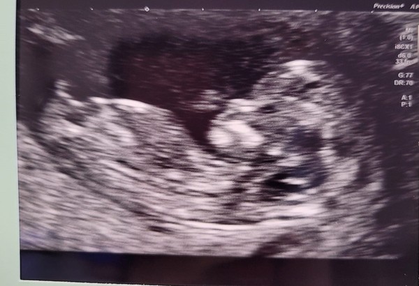 What we think Boy or Girl?