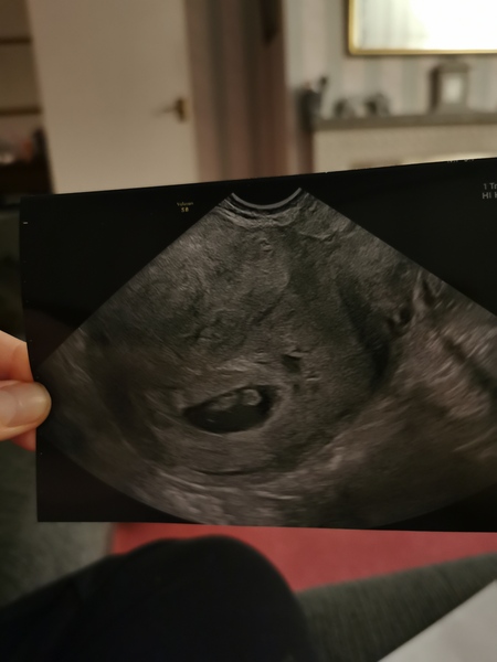 Early scan pics?