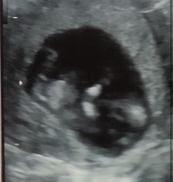 Posting scan pictures for another member. NUB guesses please