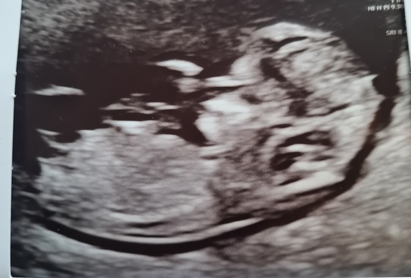 12 week gender guess?
