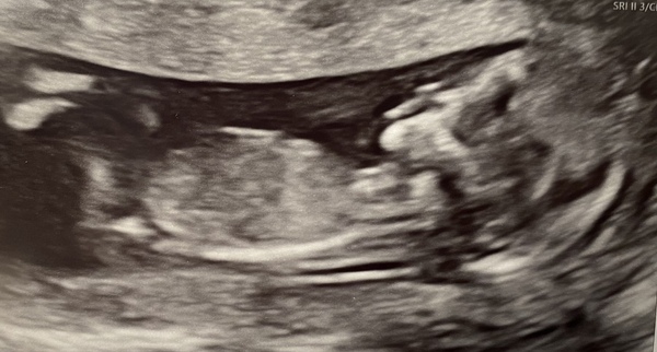 Due September 2022 (Thread 4)