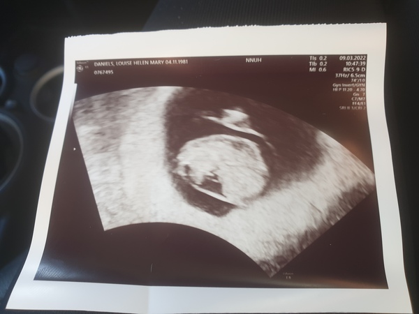 Due October 2022 thread #2 ... the first trimester continues!