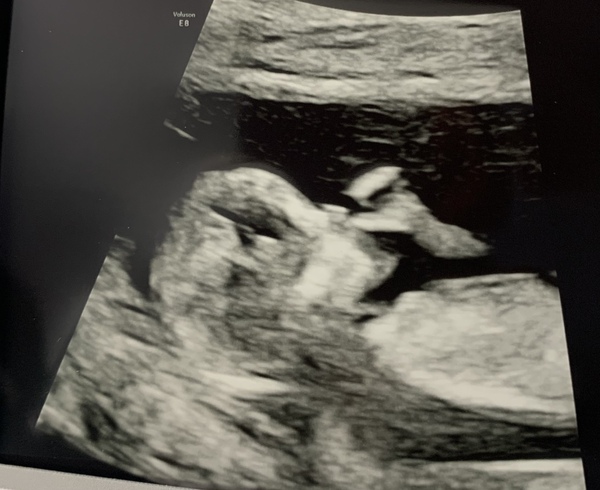 Due September 2022 (Thread 4)