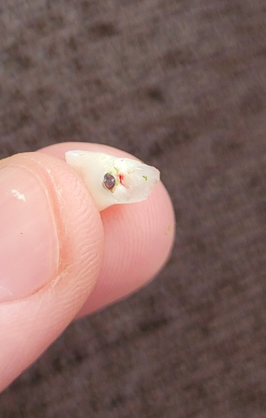 Baby tooth fallen out but looks rotten inside?