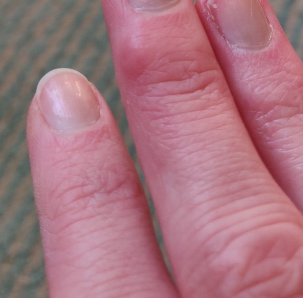 To ask you to help me work out what's going on with my fingers?