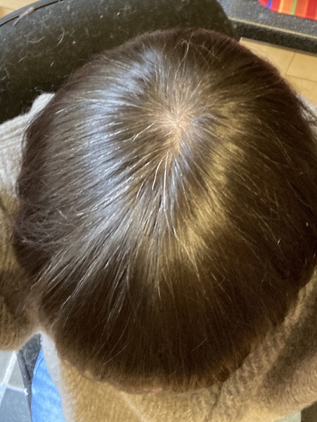 Anyone else going grey in 2022?