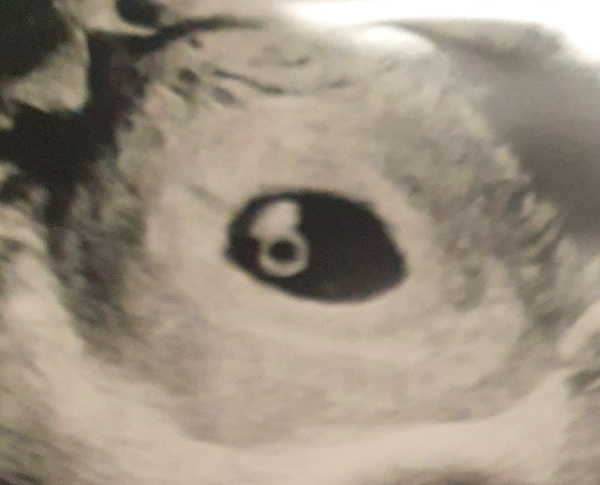 Due late Oct 🎃 - early Nov 🎉