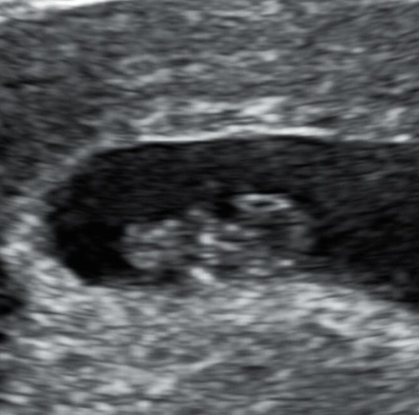 Due October 2022 thread #2 ... the first trimester continues!