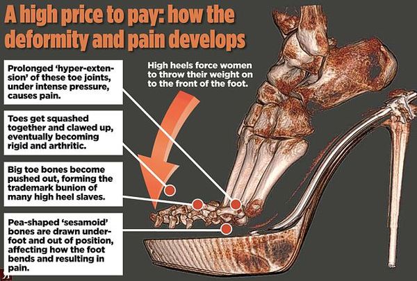 Ridiculously high heels - Apprentice Final Four