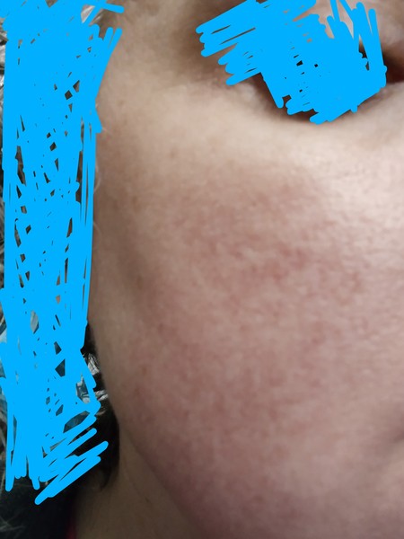 How to improve my skin in my 40s (pic attached)