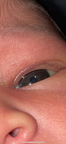 Baby eye colour