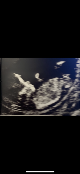 Due September 2022 (Thread 4)