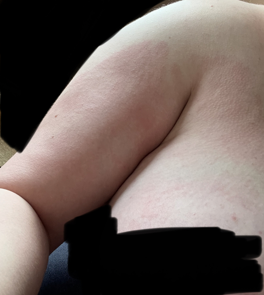 What to wash with - allergic to soaps? (Photo - TMI)