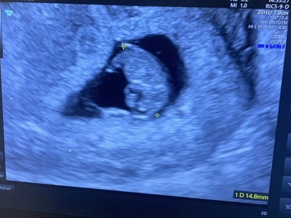Due late Oct 🎃 - early Nov 🎉