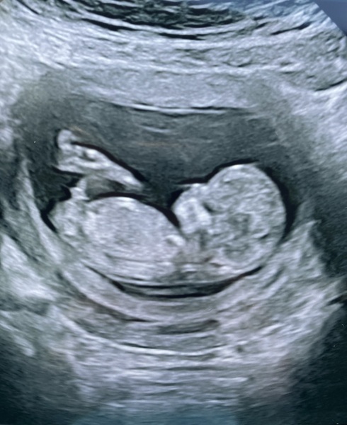 Nub theory gender guess (just for fun!)