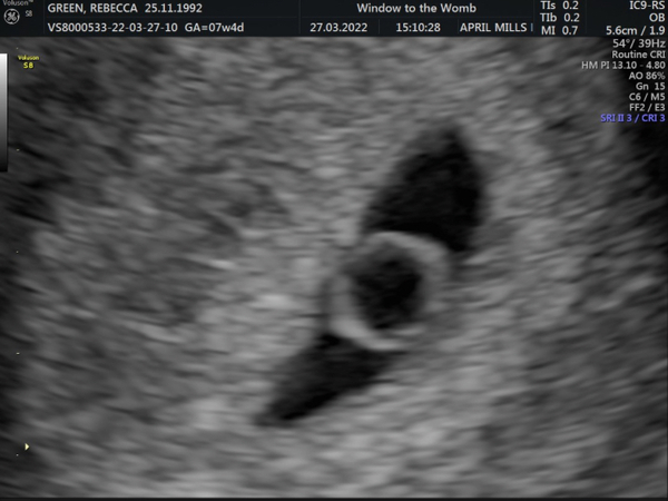 Please help, inconclusive scan