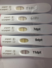 IVF , do you inject ovaleap injection in thigh or tummy?