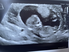Gender guesses?