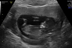 Gender guesses?